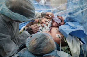 A baby is skin to skin during a cesarean birth.